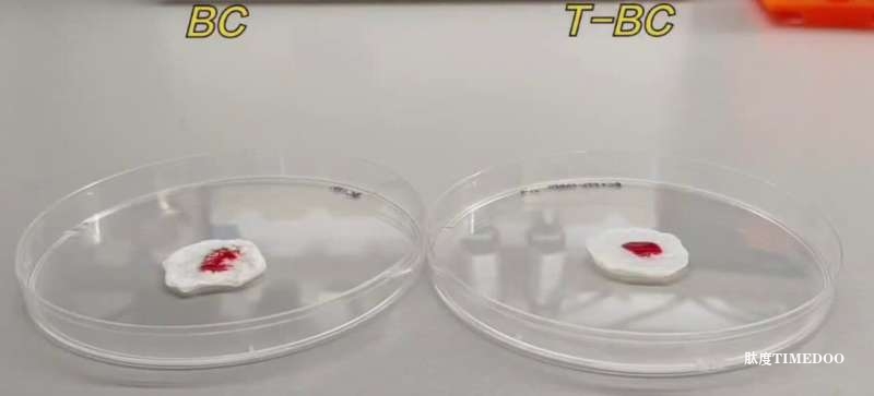 创新止血材料问世，助力烧伤手术控血与愈合
