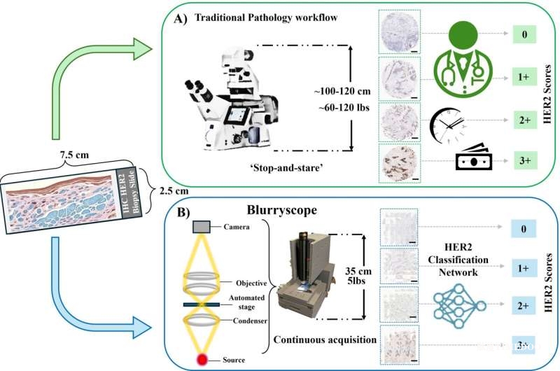 UCLA团队研发“BlurryScope”：用AI解锁模糊影像，低成本实现乳腺癌HER2检测