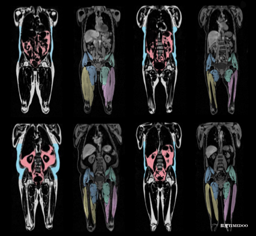 这才是科学家眼中的“长寿身材”:1个部位要细,2个地方要粗-肽度TIMEDOO