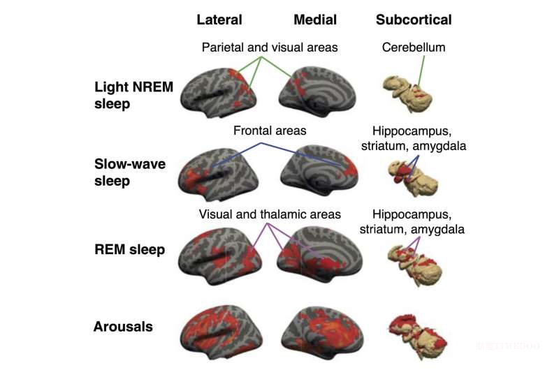 深度睡眠如何清理大脑?日本研究揭示脑脊液与慢波脑活动的神秘同步-肽度TIMEDOO