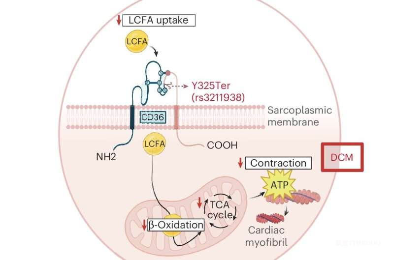 科学家发现：CD36基因变异或解释黑人群体扩张型心肌病高发原因