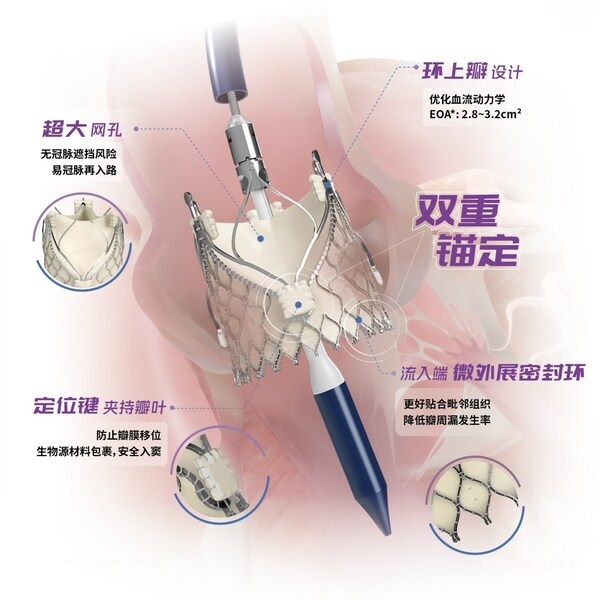 沛嘉医疗TaurusTrio经导管主动脉瓣系统获NMPA批准上市,重磅核心产品为瓣膜业务增长再添强劲引擎-肽度TIMEDOO