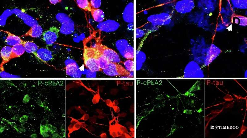 科学家开发出选择性抑制剂，精准靶向 APOE4 遗传相关的脑炎症