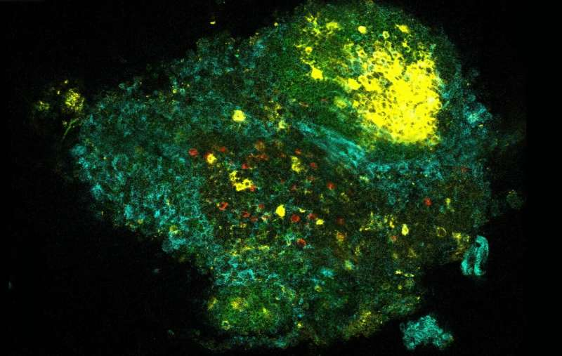 耶鲁大学《自然》发文：微生物暴露如何重塑免疫记忆并预防过敏