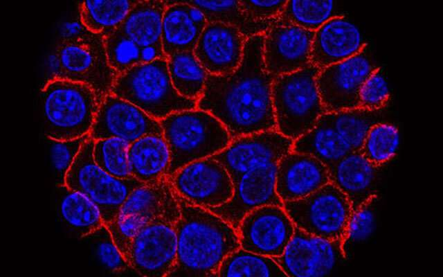 《PNAS》：西班牙国家癌症研究中心开发“三联疗法”，在动物模型中根除胰腺癌并攻克耐药