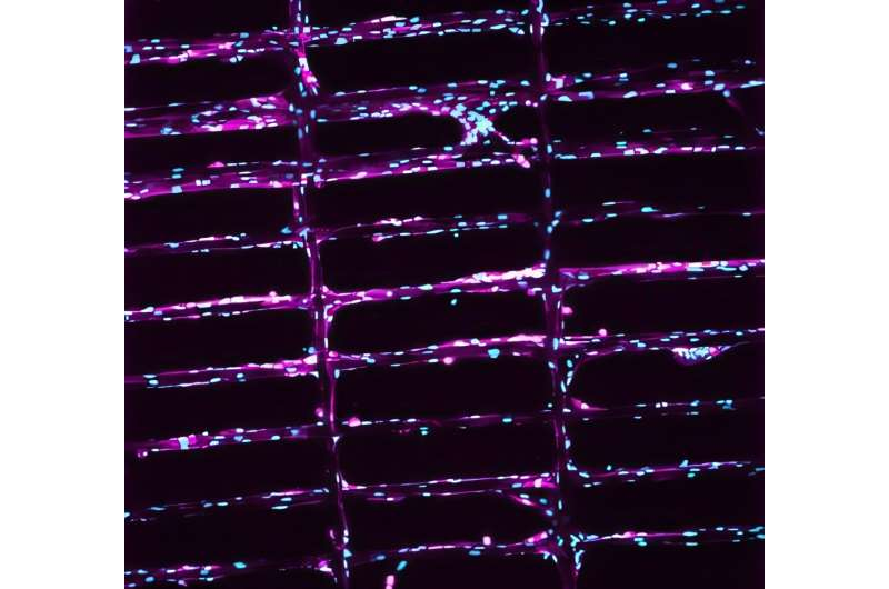 俄勒冈大学开发 3D 打印微型支架，为重度肌肉损伤提供修复“路线图”