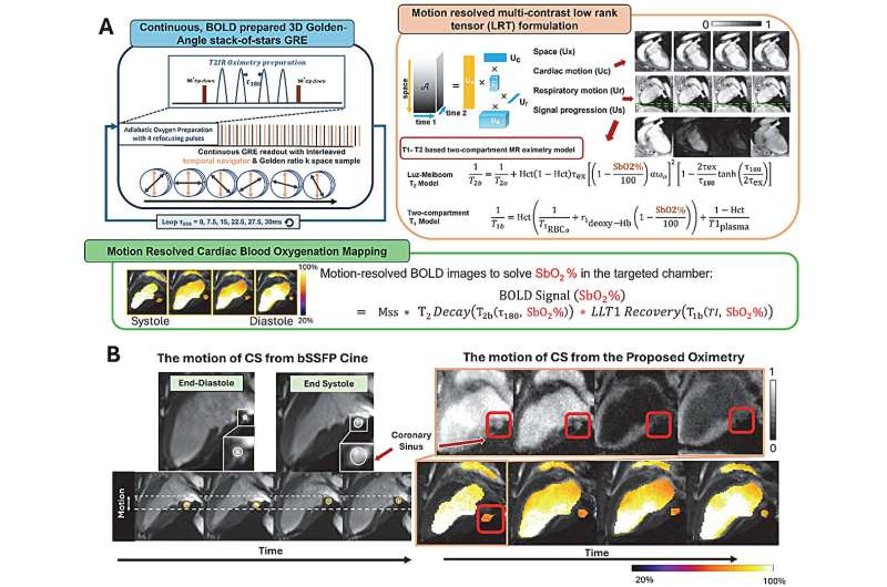 Cedars-Sinai 研发新型 MRI 系统，3 分钟无创评估心脏耗氧量