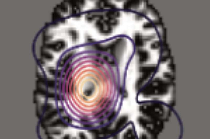 《自然-神经科学》:哈佛团队开发 BrainIAC 基础模型,开启神经影像 AI 的“通用时代”-肽度TIMEDOO
