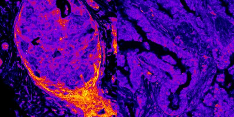 《自然-通讯》：打破细胞生物学边界，科学家首次绘制人类“核代谢指纹”图谱