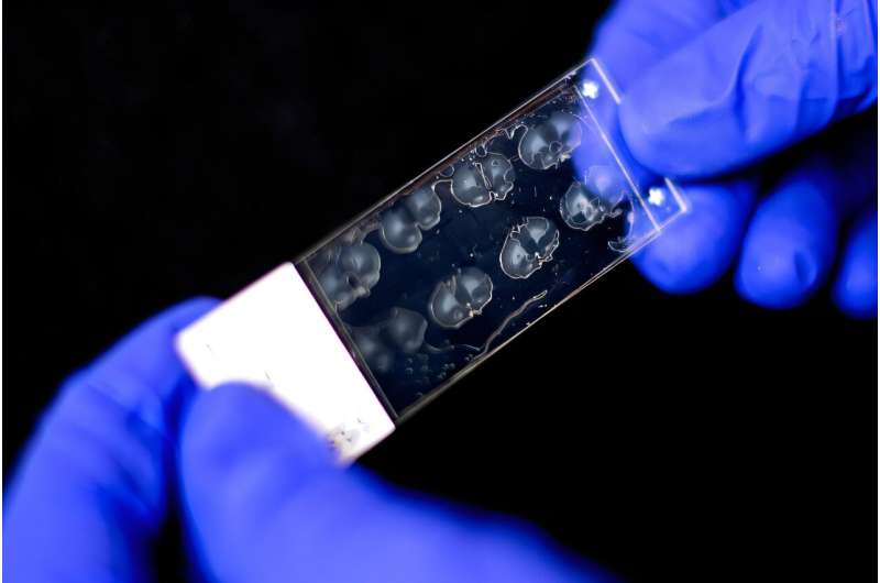 大脑重塑新线索，怀孕或将长期削弱恐惧记忆