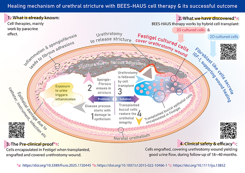 再生医学的重大突破BEES-HAUS细胞疗法：旁分泌效应与细胞嫁接，以及修复尿道狭窄；其简化版BHES-HAUS的结果将在AUA 2026上发布