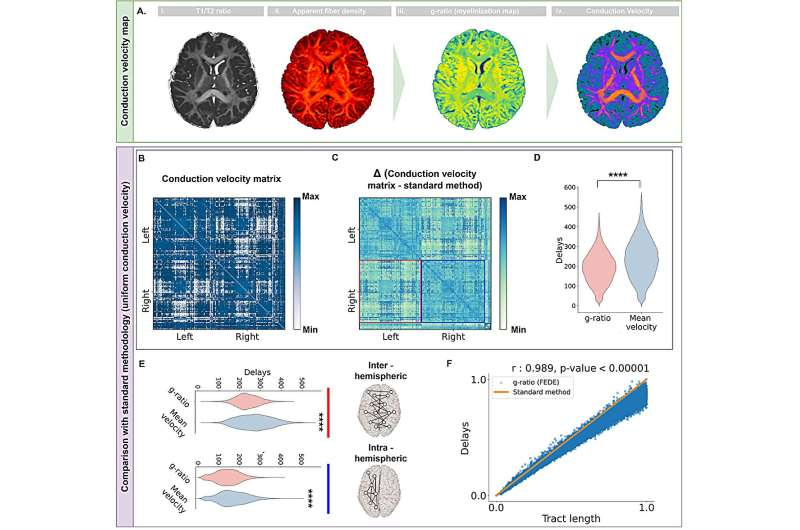 《PLOS Digital Health》:科研人员构建2岁自闭症患儿高保真数字孪生脑模型 揭示皮层深处神经元兴奋/抑制失衡-肽度TIMEDOO
