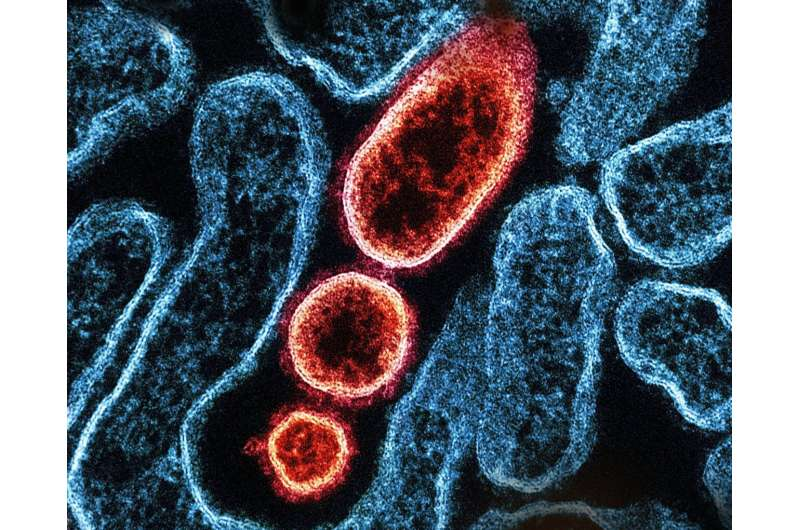 治银屑病不用压制免疫系统了？科学家找到了一个更聪明的靶点