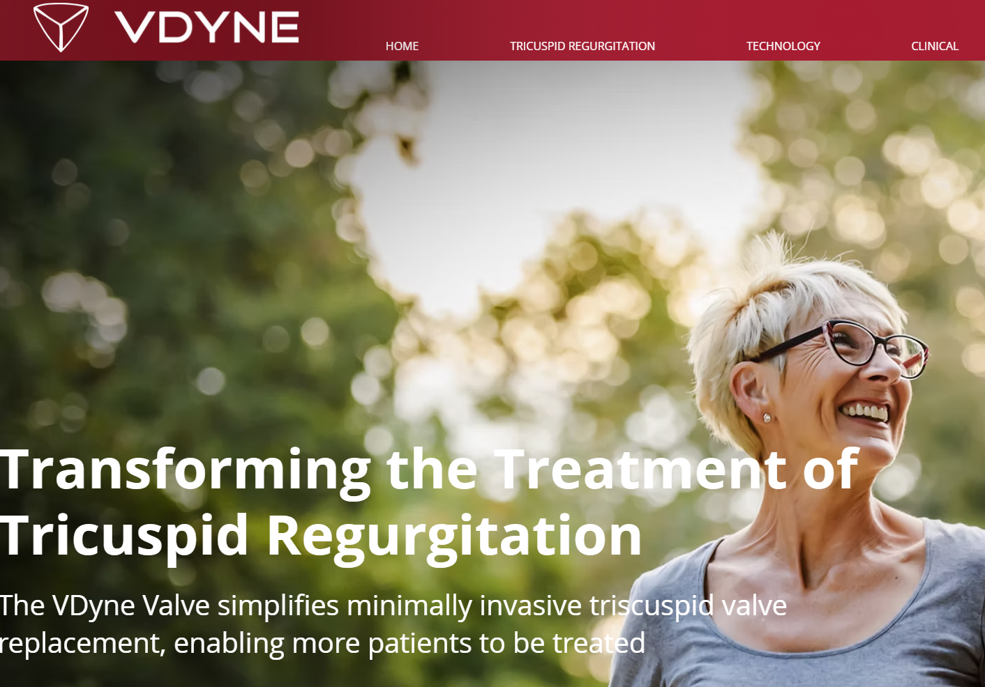 VDyne 宣布 TriNova™ 经导管三尖瓣置换系统 TRIVITA 美国 IDE 关键性研究完成首例患者治疗
