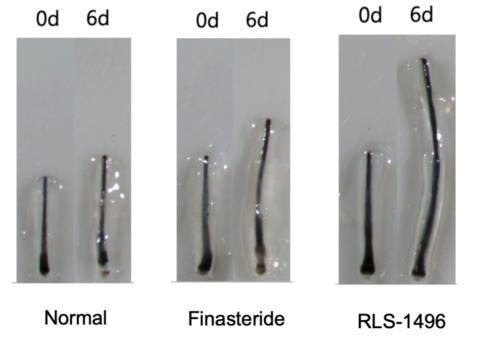 Rubedo Life Sciences宣布将开展GPX4调节剂RLS-1496治疗脱发的临床研究，首个人体离体研究证据显示其可有力促进毛囊生长