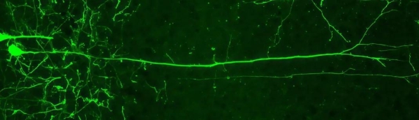 科学家揭示认知灵活性的树突计算机制-肽度TIMEDOO